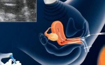 2026年湘西私立三代试管婴儿机构排名出炉