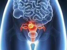 佛山三代试管婴儿费用，一次试管究竟要花多少？