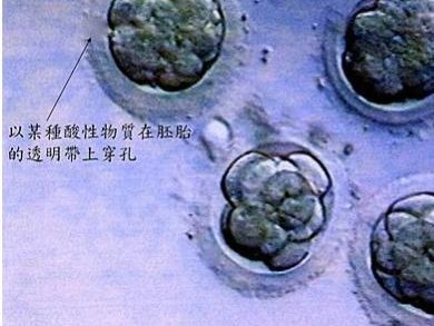 2026年去广州省妇幼保健院做试管婴儿多少钱？费用会不会很高？